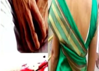 पति-पत्नी के बीच हुआ विवाद तो पत्नी ने काट लिया पति का दांत से गुप्तांग